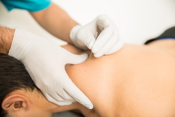 Dry needling consultation