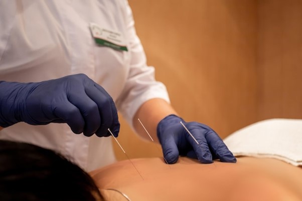 Dry needling session