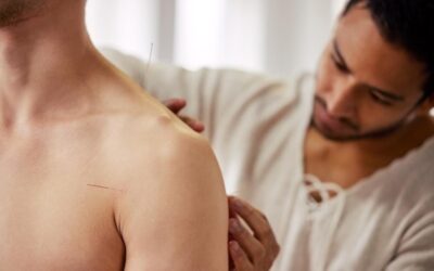Dry Needling in Ipswich: Everything You Need to Know Before Your First Session