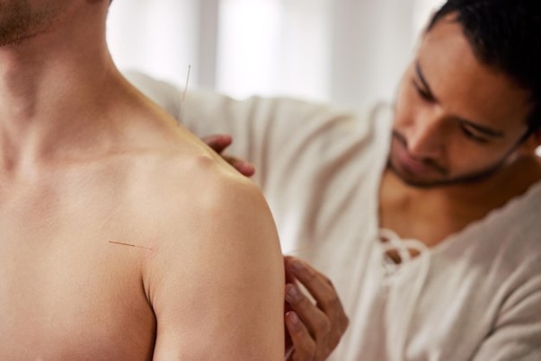 Dry needling treatment Dry needling treatment